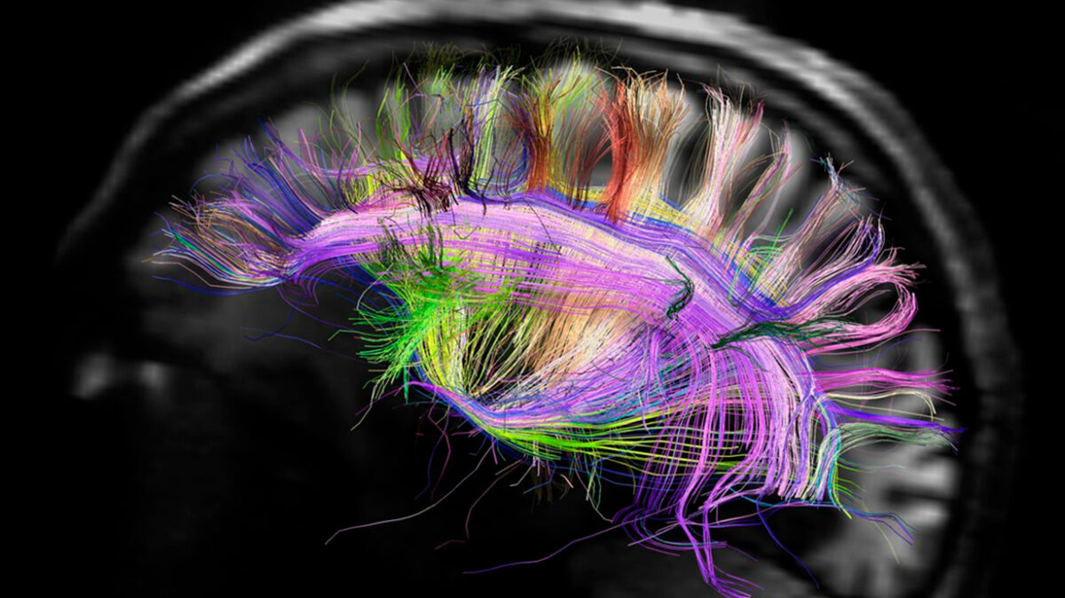 Metrics, Metricser, Colaboraciones, emociones, neuroinformática, análisis de datos,